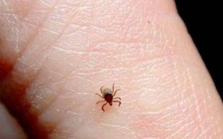 Han muerto siete personas por rickettsia en Ciudad Juárez